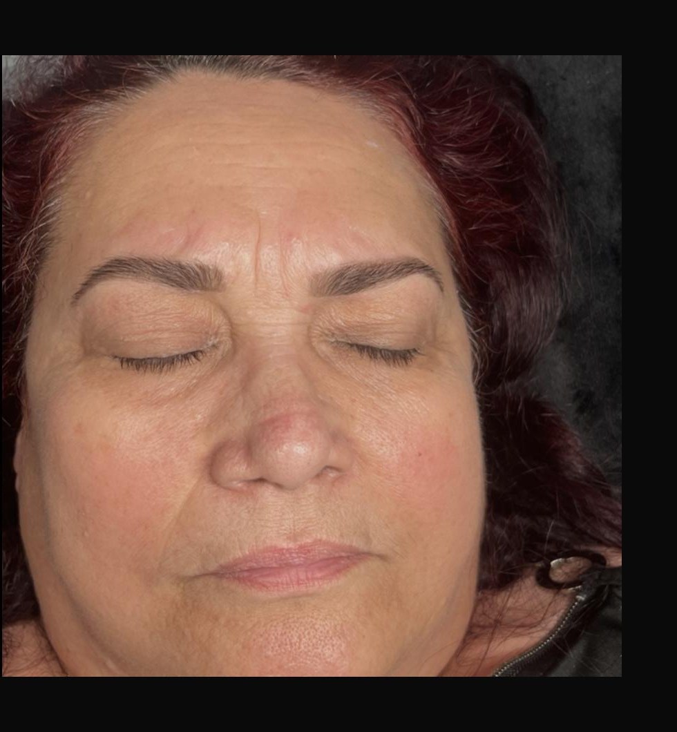 Before lash and brow