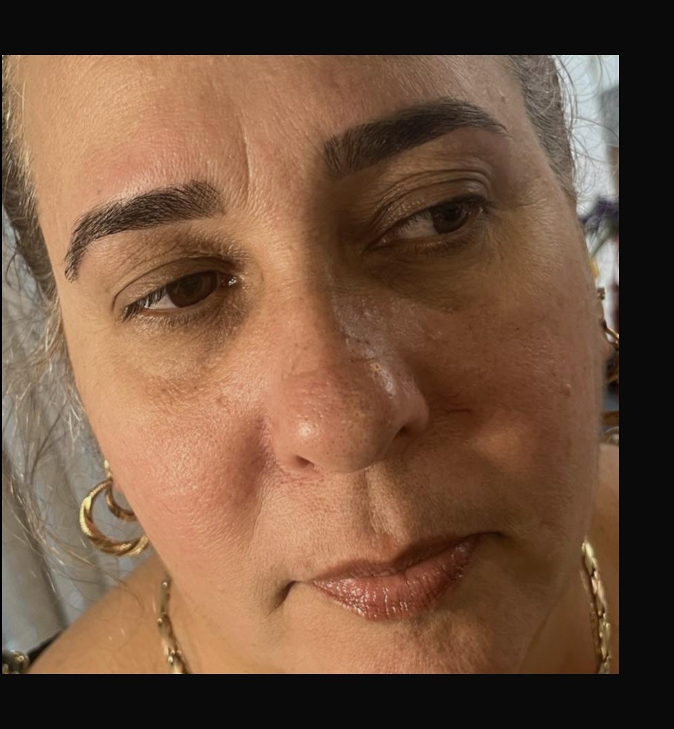 Before brow threading
