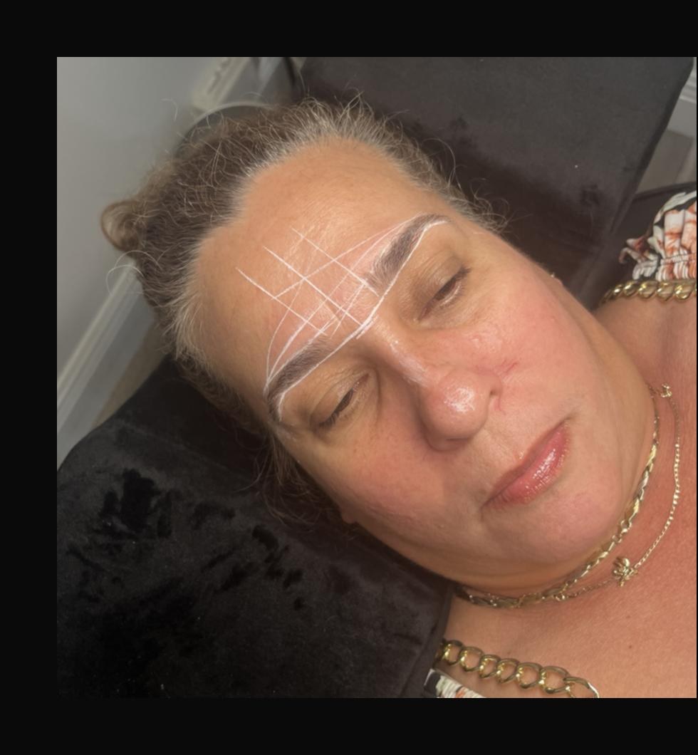 After brow threading