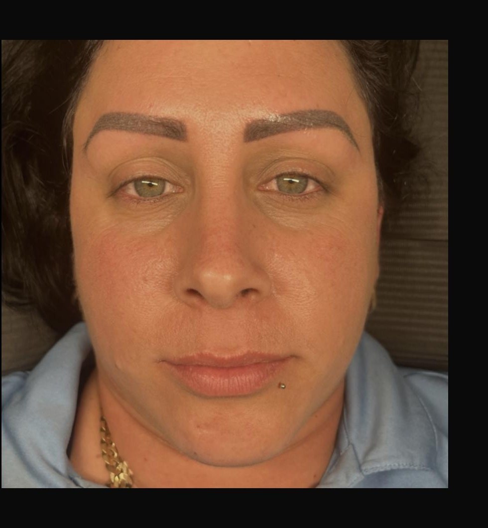 After brow transformation