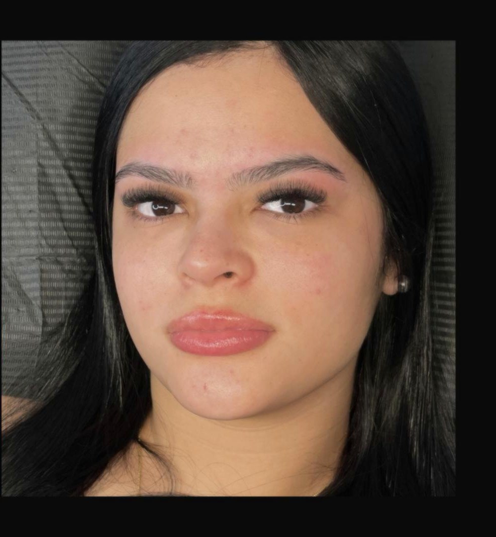 Before classic lash