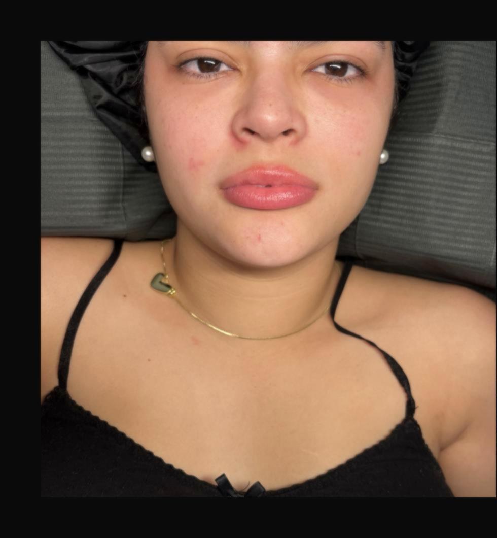 After classic lash