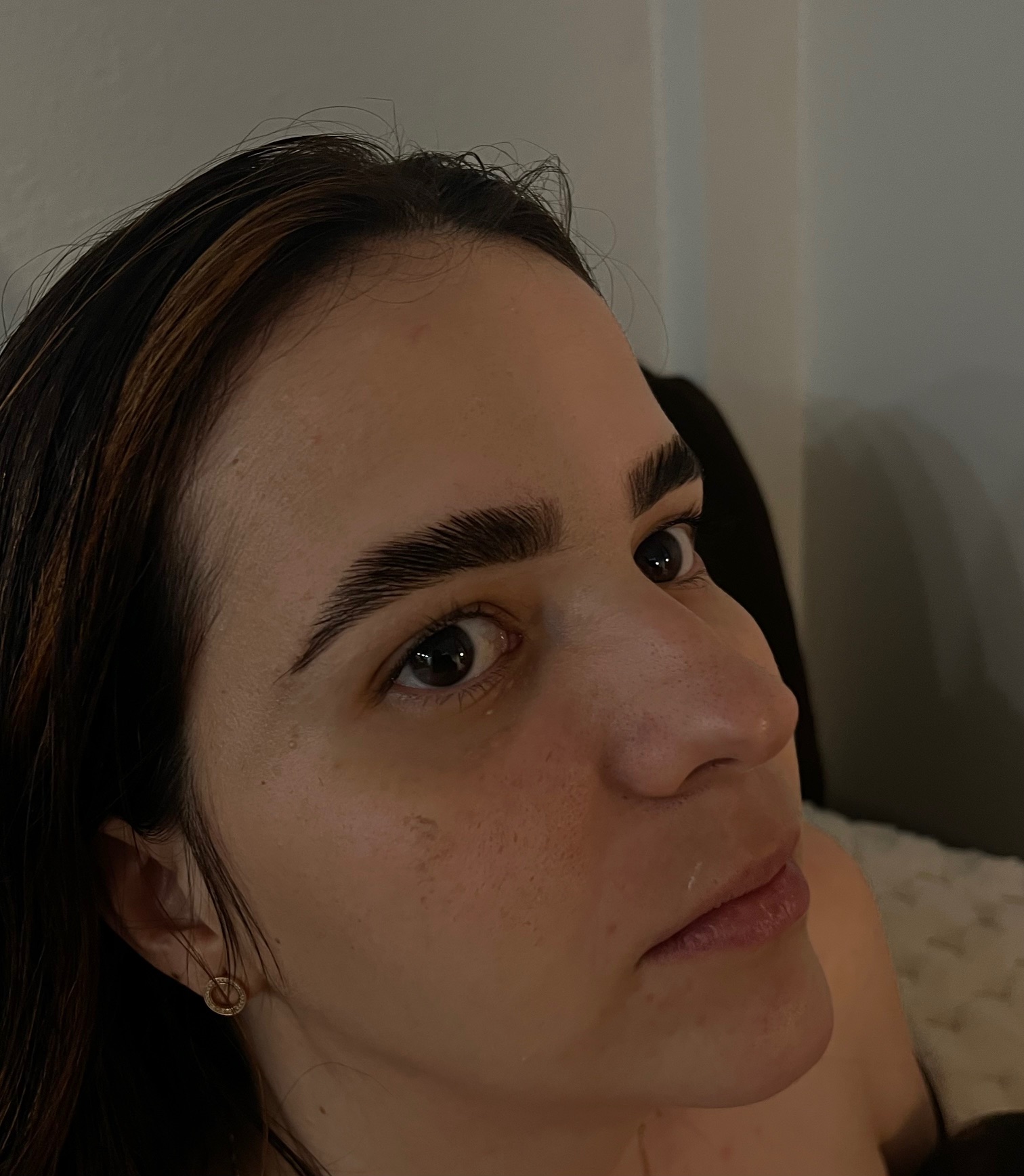 Before brow service