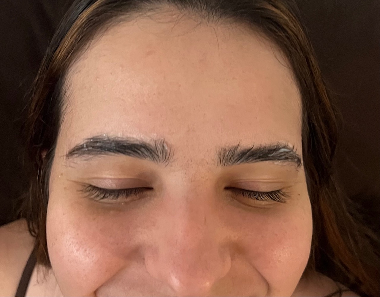 After brow service